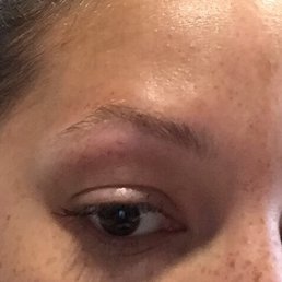 Right eyebrow