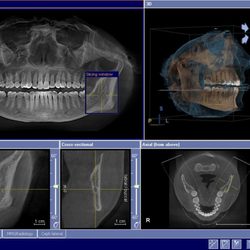 Hancock Dental