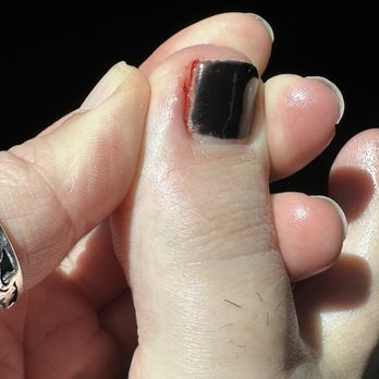 Luxury Nails Spa - Blood mixed with gel polish! - Nail Salons Near Me - Rancho Cucamonga, California Luxury Nails Spa - Blood mixed with gel polish! - Nail Salons Near Me - Rancho Cucamonga, California
