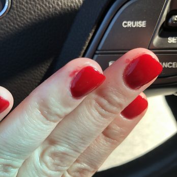 Super Nails - Bad nail job. - Nail Salons Near Me - Chicago, Illinois Super Nails - Bad nail job. - Nail Salons Near Me - Chicago, Illinois