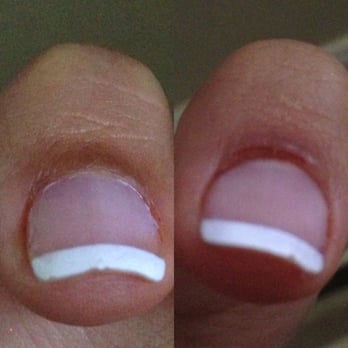 Nailspa Excel - Left side is my okay thumb the right is the one he messed up on and made me bleed. It's still in pain and in bad condition. - Nail Salons Near Me - Hawthorne, California Nailspa Excel - Left side is my okay thumb the right is the one he messed up on and made me bleed. It's still in pain and in bad condition. - Nail Salons Near Me - Hawthorne, California