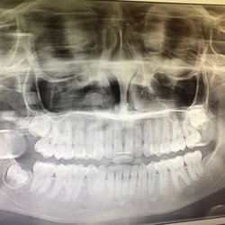 Eastern Oklahoma Oral & Maxillofacial Surgery