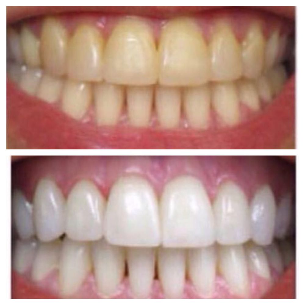 PEARLY WHITES BY TANYA Updated September 2024 18 Photos & 29
