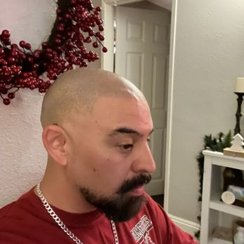 Precise Scalp Micro  - Self confidence booster! - Hair Loss Centers Near Me - Rancho Cucamonga, California