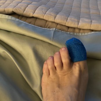 S.I. Podiatry: Richard A. Rouder, DPM, PC - Ingrown toenail - Podiatrists Near Me - Staten Island, New York S.I. Podiatry: Richard A. Rouder, DPM, PC - Ingrown toenail - Podiatrists Near Me - Staten Island, New York