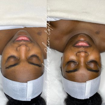 Moore Than Skin Esthetics - Skin Care Near Me Moore Than Skin Esthetics - Skin Care Near Me
