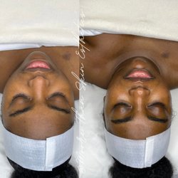 Moore Than Skin Esthetics