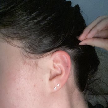 All About Ink - Irritated and keloid on the front - Tattoo Near Me - Pensacola, Florida All About Ink - Irritated and keloid on the front - Tattoo Near Me - Pensacola, Florida