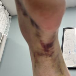 OrthoIndy