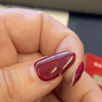 Diamond Nails - Less than one week in cracked/broken nail low on nail bed. (Gel) - Nail Salons Near Me - Naples, Florida Diamond Nails - Less than one week in cracked/broken nail low on nail bed. (Gel) - Nail Salons Near Me - Naples, Florida