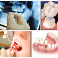 Bupa Dental Arndale