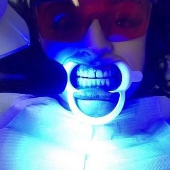 Jamila Salon And Spa - Teeth whitening in the process - Hair Salons Near Me - Hamilton, Ontario Jamila Salon And Spa - Teeth whitening in the process - Hair Salons Near Me - Hamilton, Ontario