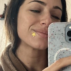 Scott C Rackett, MD - Manhattan Beach Dermatology - All I have to worry about now, is that one monthly pimple!