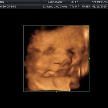 See Me Mommy 4D - Diagnostic Imaging Near Me - Snellville, Georgia See Me Mommy 4D - Diagnostic Imaging Near Me - Snellville, Georgia