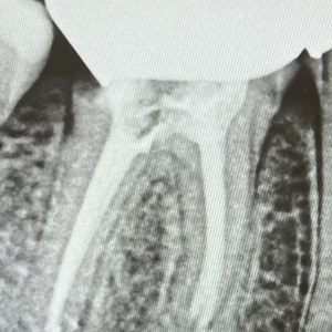 SMILE HAVEN DENTAL RANCHO CUCAMONGA visual data 4