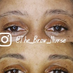 The Brow Nurse - Microblade