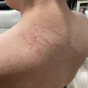 Yu Spa - Scratch marks from the body scrub - Day Spas Near Me - San Diego, California Yu Spa - Scratch marks from the body scrub - Day Spas Near Me - San Diego, California