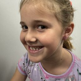 My angels pierced ears about a minute after the piercing My angels pierced ears about a minute after the piercing