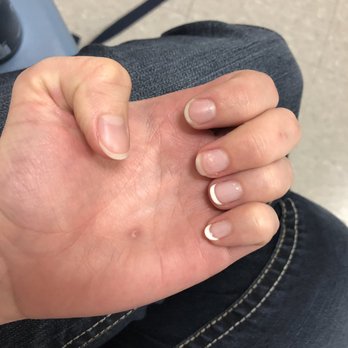 Enjoy Nails & Spa - Three nails peeled off so far on this hand. - Nail Salons Near Me - Austin, Texas Enjoy Nails & Spa - Three nails peeled off so far on this hand. - Nail Salons Near Me - Austin, Texas
