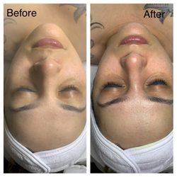 Glo Skin Workz - Here at Glo Skin Workz we specialize in safe and effective treatments for Ethnic Skin. Before and After Rejuvenating Facial !