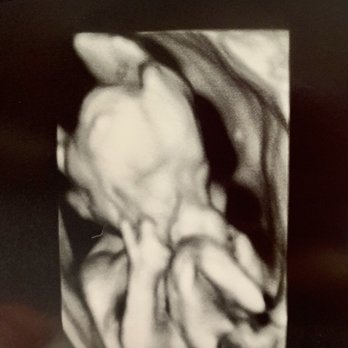Shahin Ghadir, MD - Even our little guy gives Dr Ghadir a thumbs up - Fertility Near Me - Beverly Hills, California Shahin Ghadir, MD - Even our little guy gives Dr Ghadir a thumbs up - Fertility Near Me - Beverly Hills, California