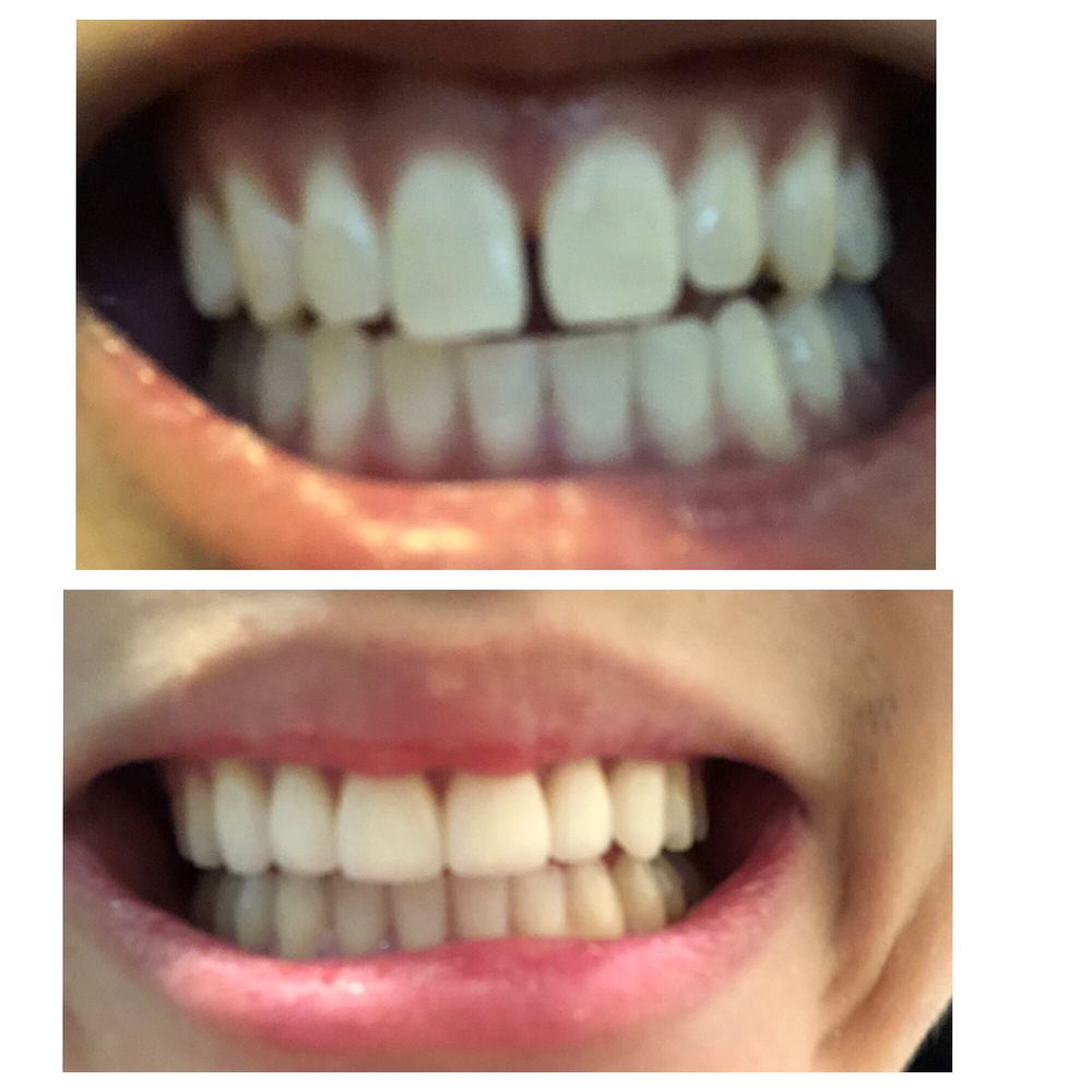 ADVANCED DENTAL CARE 13 Photos & 24 Reviews Cosmetic