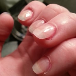 This was taken 2 hrs after a fill. The polish had chipped off, you can see my natural nail, and they filed at an odd angle. This was taken 2 hrs after a fill. The polish had chipped off, you can see my natural nail, and they filed at an odd angle.