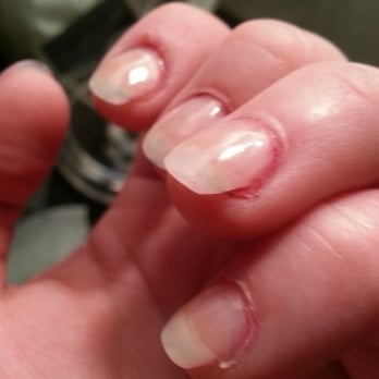 Q & N Nails - This was taken 2 hrs after a fill. The polish had chipped off, you can see my natural nail, and they filed at an odd angle. - Nail Salons Near Me - Garden City, Michigan Q & N Nails - This was taken 2 hrs after a fill. The polish had chipped off, you can see my natural nail, and they filed at an odd angle. - Nail Salons Near Me - Garden City, Michigan