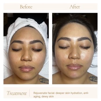 Babe Cave Hawaii - 8/24 Facial with Ariana - Before & After - Eyelash Service Near Me - Honolulu, Hawaii Babe Cave Hawaii - 8/24 Facial with Ariana - Before & After - Eyelash Service Near Me - Honolulu, Hawaii