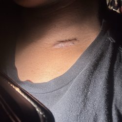 Skin Cancer Specialists and Aesthetic Center - Again the aftermath that constantly hurts and stings out of nowhere