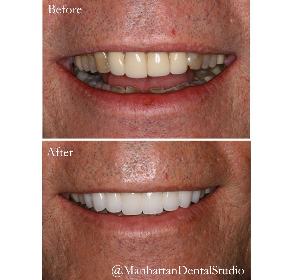 MANHATTAN DENTAL STUDIO 29 Photos & 38 Reviews 358 5th Ave, New