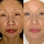 Natural Rejuvenation MedSpa