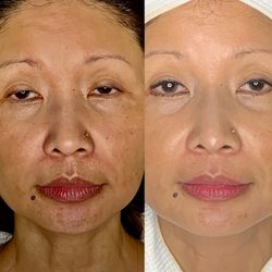 Natural Rejuvenation MedSpa