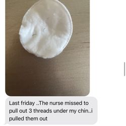 Riverside Plastic Surgery Associates - Stitches that were not removed properly.