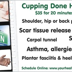 For Your Health - Cupping for various conditions.