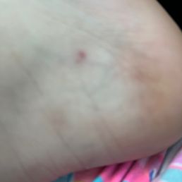 Here is what they did to my feet
