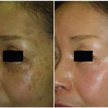 Aura Beauty Center - Tattoo Near Me - Flushing, New York