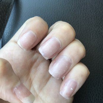 Happy Nails - Sonoma - In reference to my review. Damaged nail beds - Nail Salons Near Me - Sonoma, California Happy Nails - Sonoma - In reference to my review. Damaged nail beds - Nail Salons Near Me - Sonoma, California