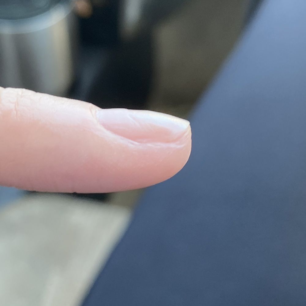 More nail damage