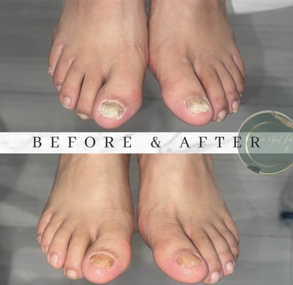 Wellness Medical Pedicure - Customized waterless pedicure that targets our clients specific needs such as nail debridement and excess callus removal.. Along with exfoliation of dead skin. Please text 813-596-8533 a picture of the current condition of your feet to determine your stage Wellness Medical Pedicure - Customized waterless pedicure that targets our clients specific needs such as nail debridement and excess callus removal.. Along with exfoliation of dead skin. Please text 813-596-8533 a picture of the current condition of your feet to determine your stage
