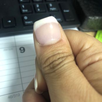 Sparkle Nails & Spa - Thick lopsided nail - Nail Salons Near Me - Miramar, Florida Sparkle Nails & Spa - Thick lopsided nail - Nail Salons Near Me - Miramar, Florida