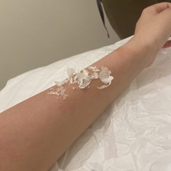 Pacfe Nails & Spa - This photo shows the strip and wax stuck to my skin while they repeatedly attempt to rip it off. The wax was not coming off. - Nail Salons Near Me - Centereach, New York
