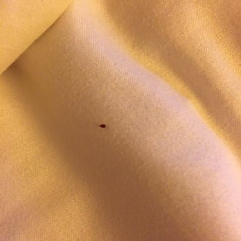 European Hostel - Hard to tell but that is a motherfucking bedbug full of blood and when I tried to pick it up it squirted blood everywhere. - Hostels Near Me - San Francisco, California European Hostel - Hard to tell but that is a motherfucking bedbug full of blood and when I tried to pick it up it squirted blood everywhere. - Hostels Near Me - San Francisco, California