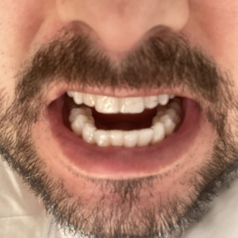 Willowbrook Dental Clinic - General Dentistry Near Me - Langley, British Columbia Willowbrook Dental Clinic - General Dentistry Near Me - Langley, British Columbia