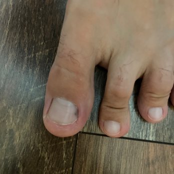 Touch Nail Spa - The cut on my hubby's toe - he can't bend his toe. - Nail Salons Near Me - Wesley Chapel, Florida Touch Nail Spa - The cut on my hubby's toe - he can't bend his toe. - Nail Salons Near Me - Wesley Chapel, Florida