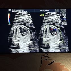 New Life Imaging - Ultrasound