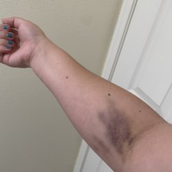 Quest Diagnostics - The aftermath of my appointment.