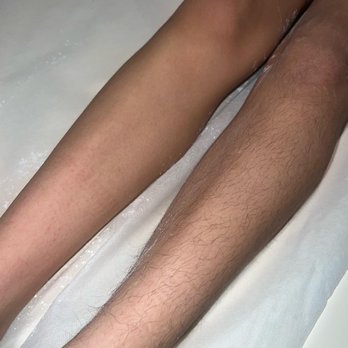 Omnia Esthetics Sugaring - Hair removal from the legs - Sugaring Near Me - West Covina, California Omnia Esthetics Sugaring - Hair removal from the legs - Sugaring Near Me - West Covina, California