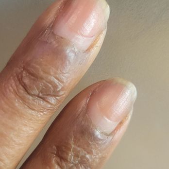 The Nail Loft - You can see in this photo where my nail is growing back healthy and where the line is where they filed. No Bueno. - Nail Salons Near Me - Washington, DC, District of Columbia The Nail Loft - You can see in this photo where my nail is growing back healthy and where the line is where they filed. No Bueno. - Nail Salons Near Me - Washington, DC, District of Columbia