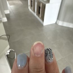 Whole nail popped off